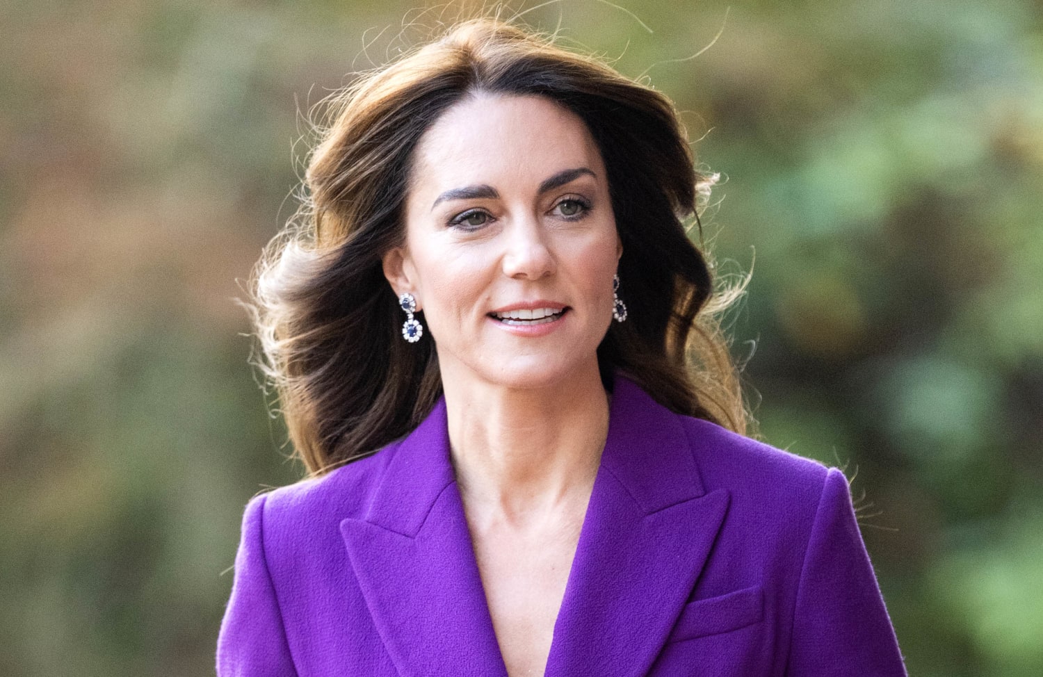 Αισιοδοξία για την Kate Middleton  – Ο οργανισμός της ανταποκρίνεται στη θεραπεία