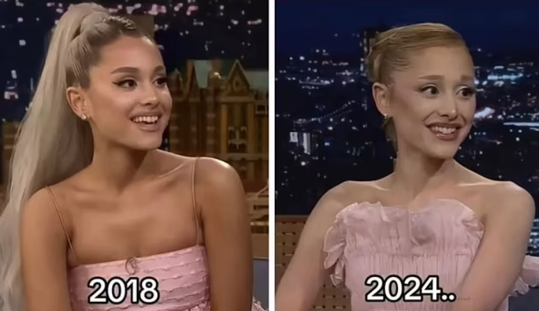 Ariana Grande: Η σοκαριστική αλλαγή στην εμφάνιση της – Τι λένε οι ειδικοί